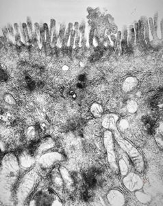 celiakia celiakia